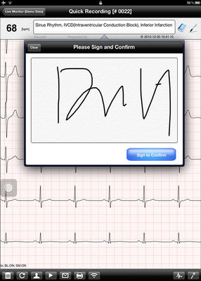 Mini Wireless ECG Device for IOS system ecg monitoring system