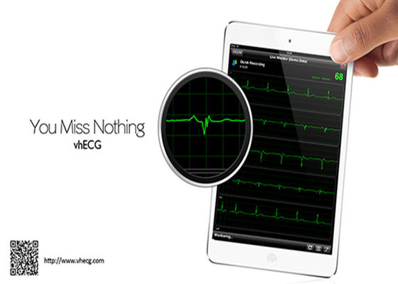 Mini Wireless ECG Device for IOS system ecg monitoring system