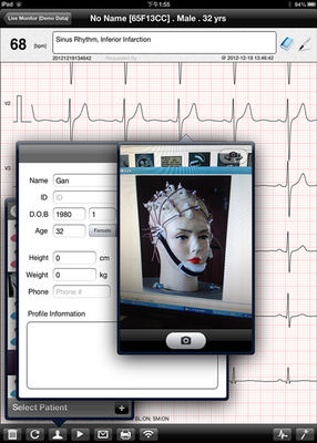Pocket EKG Wireless ECG Machine Handheld Resting ECG Device For IOS System